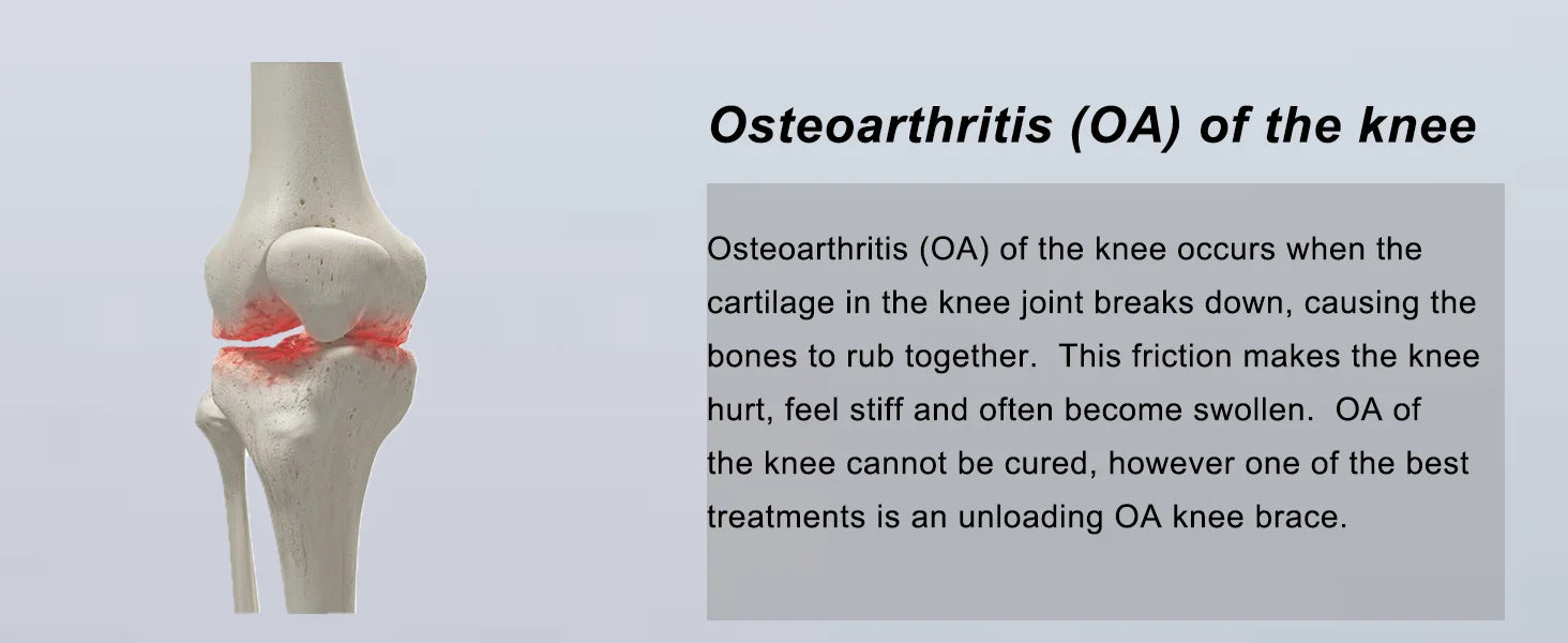 Ginocchiera per scarico OA per uomo donna, ACL, MCL, dolore per osteoartrite e artrite, ginocchiera incernierata per degenerazione delle articolazioni ossee