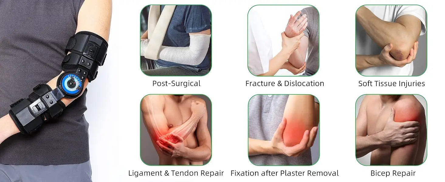 Tutore per gomito ROM incernierato, stecca stabilizzatrice post-operatoria regolabile, supporto per il recupero delle infortuni del braccio Riabilitazione dell'immobilizzazione delle fratture